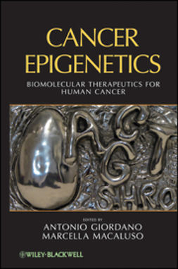 Giordano, Antonio - Cancer Epigenetics: Biomolecular Therapeutics in Human Cancer, ebook