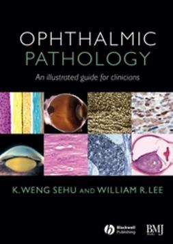 Lee, William R. - Ophthalmic Pathology: An Illustrated Guide for Clinicians, e-bok