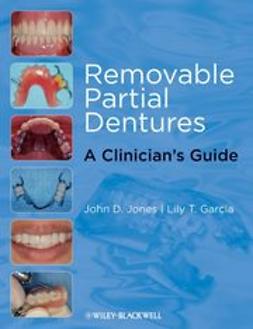 Jones, John D. - Removable Partial Dentures: A Clinician's Guide, e-kirja