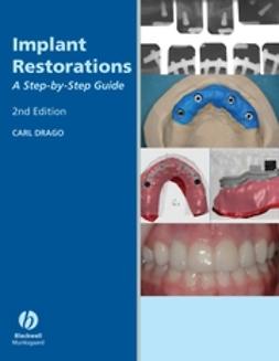 Drago, Carl - Implant Restorations: A Step-by-Step Guide, ebook