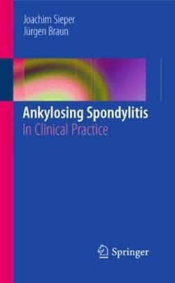 Sieper, Joachim - Ankylosing Spondylitis, ebook