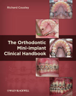 Cousley, Richard - The Orthodontic Mini-implant Clinical Handbook, e-bok