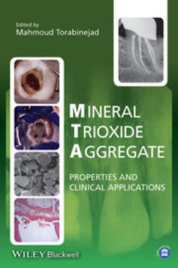 Torabinejad, Mahmoud - Mineral Trioxide Aggregate: Properties and Clinical Applications, ebook