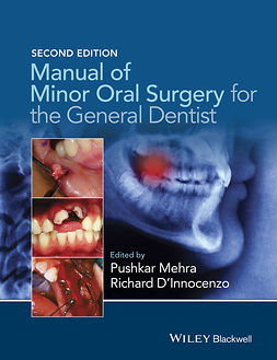 D'Innocenzo, Richard - Manual of Minor Oral Surgery for the General Dentist, e-kirja