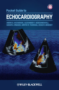 Kacharava, Andro G. - Pocket Guide to Echocardiography, e-bok