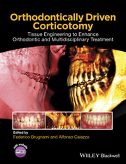 Brugnami, Federico - Orthodontically Driven Corticotomy: Tissue Engineering to Enhance Orthodontic and Multidisciplinary Treatment, ebook