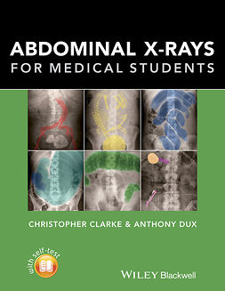 Clarke, Christopher - Abdominal X-rays for Medical Students, ebook