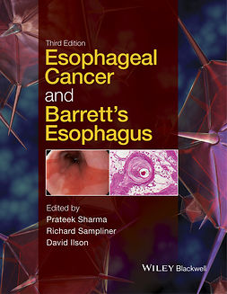 Ilson, David - Esophageal Cancer and Barrett's Esophagus, ebook