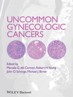 Carmen, Marcela del - Uncommon Gynecologic Cancers, ebook