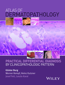 Burg, Gunter - Atlas of Dermatopathology: Practical Differential Diagnosis by Clinicopathologic Pattern, ebook