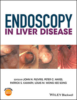 Hayes, Peter C. - Endoscopy in Liver Disease, ebook