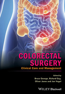 George, Bruce - Colorectal Surgery: Clinical Care and Management, e-bok