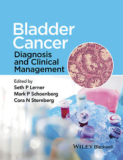 Lerner, Seth P. - Bladder Cancer: Diagnosis and Clinical Management, ebook