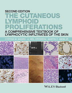 Crowson, A. Neil - The Cutaneous Lymphoid Proliferations: A Comprehensive Textbook of Lymphocytic Infiltrates of the Skin, e-kirja