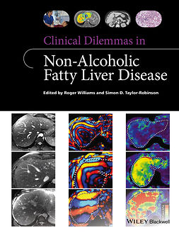 Taylor-Robinson, Simon D. - Clinical Dilemmas in Non-Alcoholic Fatty Liver Disease, ebook