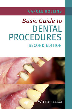 Hollins, Carole - Basic Guide to Dental Procedures, e-bok