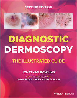 Bowling, Jonathan - Diagnostic Dermoscopy: The Illustrated Guide, ebook