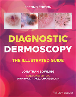 Bowling, Jonathan - Diagnostic Dermoscopy: The Illustrated Guide, e-kirja