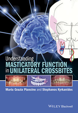 Kyrkanides, Stephanos - Understanding Masticatory Function in Unilateral Crossbites, ebook