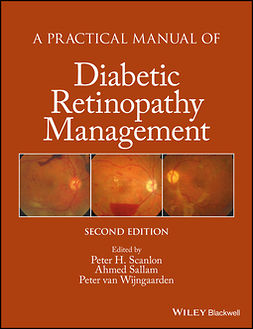 Sallam, Ahmed - A Practical Manual of Diabetic Retinopathy Management, e-bok