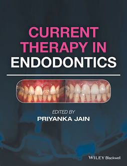 Jain, Priyanka - Current Therapy in Endodontics, e-kirja