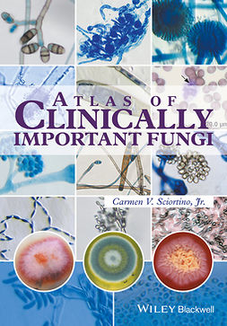 Sciortino, Carmen V. - Atlas of Clinically Important Fungi, e-kirja