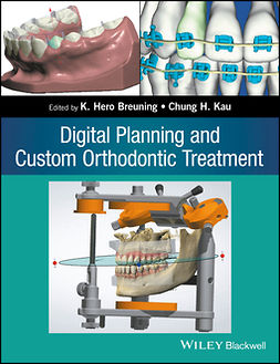 Breuning, K. Hero - Digital Planning and Custom Orthodontic Treatment, e-bok