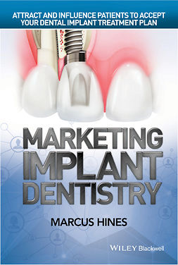 Hines, Marcus - Marketing Implant Dentistry: Attract and Influence Patients to Accept Your Dental Implant Treatment Plan, ebook