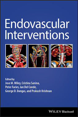 Conde, Ian Del - Endovascular Interventions, e-bok