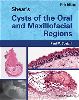 Speight, Paul M. - Shear's Cysts of the Oral and Maxillofacial Regions, e-kirja