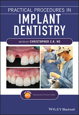 Ho, Christopher C. K. - Practical Procedures in Implant Dentistry, ebook