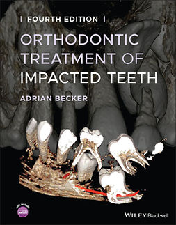 Becker, Adrian - Orthodontic Treatment of Impacted Teeth, e-kirja