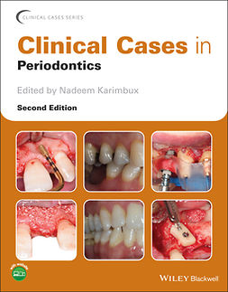 Karimbux, Nadeem - Clinical Cases in Periodontics, ebook