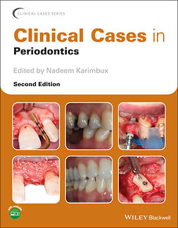 Karimbux, Nadeem - Clinical Cases in Periodontics, e-kirja
