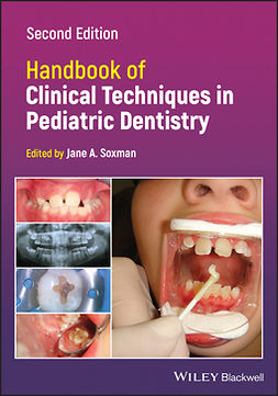 Soxman, Jane A. - Handbook of Clinical Techniques in Pediatric Dentistry, e-bok