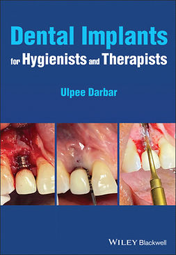 Darbar, Ulpee R. - Dental Implants for Hygienists and Therapists, e-kirja
