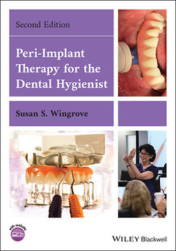 Wingrove, Susan S. - Peri-Implant Therapy for the Dental Hygienist, e-kirja