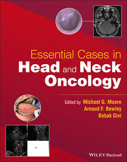 Moore, Michael G. - Essential Cases in Head and Neck Oncology, e-bok