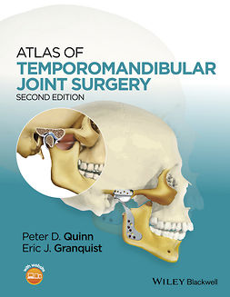 Granquist, Eric J. - Atlas of Temporomandibular Joint Surgery, e-kirja