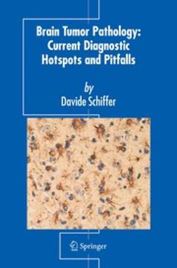 Schiffer, Davide - Brain Tumor Pathology: Current Diagnostic Hotspots and Pitfalls, e-bok