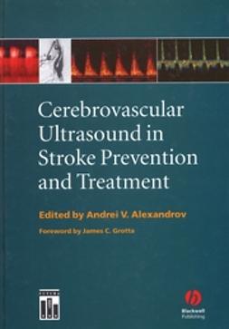 Alexandrov, Andrei V. - Cerebrovascular Ultrasound in Stroke Prevention and Treatment, e-kirja