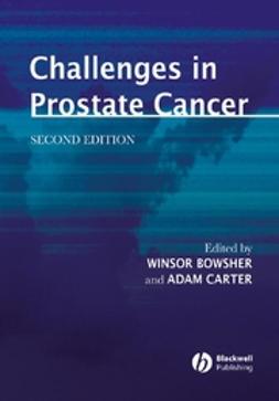 Bowsher, Winsor - Challenges in Prostate Cancer, ebook