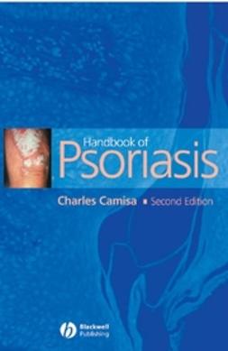 Camisa, Charles - Handbook of Psoriasis, e-kirja
