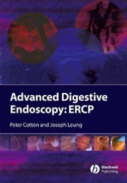Cotton, Peter B. - Advanced Digestive Endoscopy: ERCP, ebook