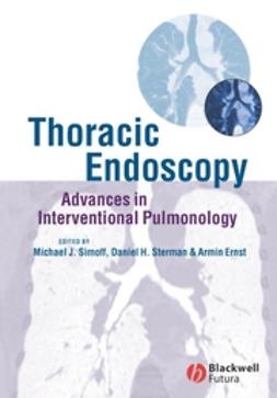 Ernst, Armin - Thoracic Endoscopy: Advances in Interventional Pulmonology, e-bok