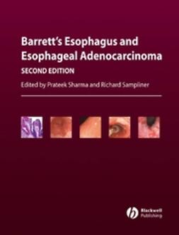 Sampliner, Richard E. - Barrett's Esophagus and Esophageal Adenocarcinoma, ebook