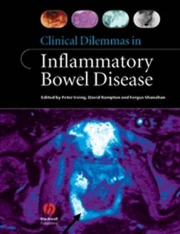 Irving, Peter - Clinical Dilemmas in Inflammatory Bowel Disease, ebook