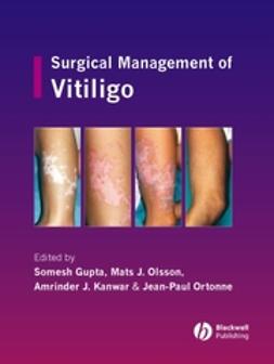 Gupta, Somesh - Surgical Management of Vitiligo, e-bok