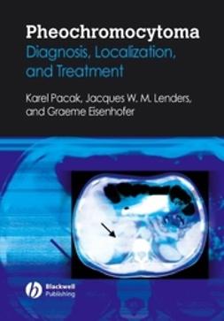 Eisenhofer, Graeme - Pheochromocytoma: Diagnosis, Localization, and Treatment, ebook