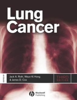 Cox, James D. - Lung Cancer, e-kirja